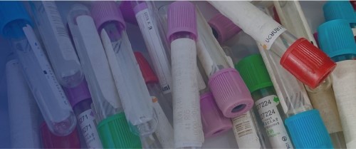 機(jī)器人引導(dǎo) 機(jī)器人系統(tǒng)